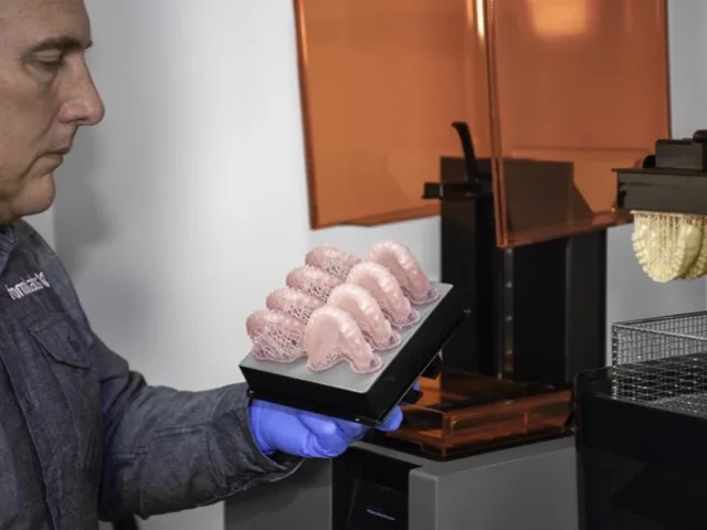 Fogtechnikus digitálisan gyártott fogpótlást készít 3D nyomtatóval